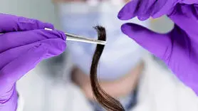 رابطه استرس مو با تشخیص افسردگی و اضطراب در کودکان !