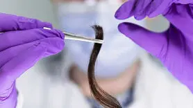رابطه استرس مو با تشخیص افسردگی و اضطراب در کودکان !