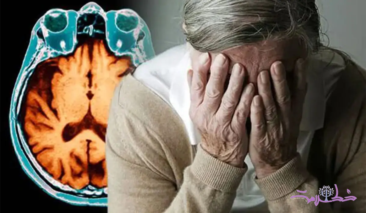 این 5 علامت نشان می دهد آلزایمر بی سر و صدا نزدیک تان شده است