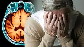 این 5 علامت نشان می دهد آلزایمر بی سر و صدا نزدیک تان شده است