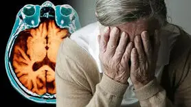 این 5 علامت نشان می دهد آلزایمر بی سر و صدا نزدیک تان شده است