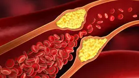 ۸ ماده غذایی مفید برای کاهش چربی خون