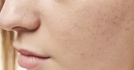 ۸ کمبود ویتامین شایع که سلامت پوست را تهدید می کند