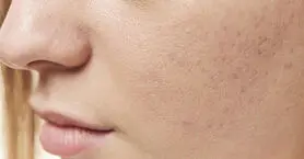 ۸ کمبود ویتامین شایع که سلامت پوست را تهدید می کند
