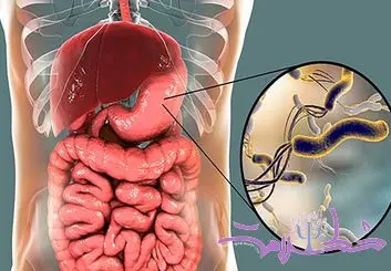 این داروی گیاهی موجب کشتن میکروب های معده می شود