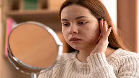 رد پای استرس را روی پوست و مو با این علائم ببینید