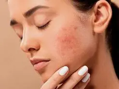از این تغییرات پوستی پی به مشکلات روده و معده تان ببرید 