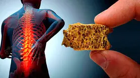 ۳ علامت اولیه شروع پوکی استخوان 