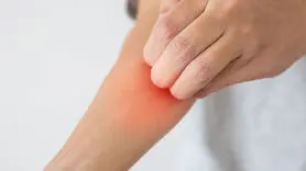 راه‌های کاهش خارش پوست بعد از اصلاح با تیغ و ژیلت