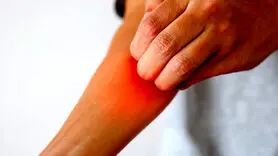 راه‌های کاهش خارش پوست بعد از اصلاح با تیغ و ژیلت