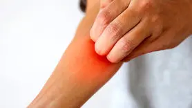 راه‌های کاهش خارش پوست بعد از اصلاح با تیغ و ژیلت