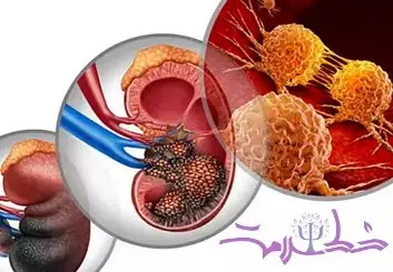 چرا نسل جوان‌تر بیشتر در معرض خطر سرطان قرار دارد؟