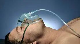 آیا بیهوشی عمومی حافظه را تحت تأثیر قرار می‌دهد؟

