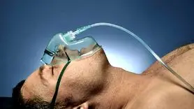 آیا بیهوشی عمومی حافظه را تحت تأثیر قرار می‌دهد؟
