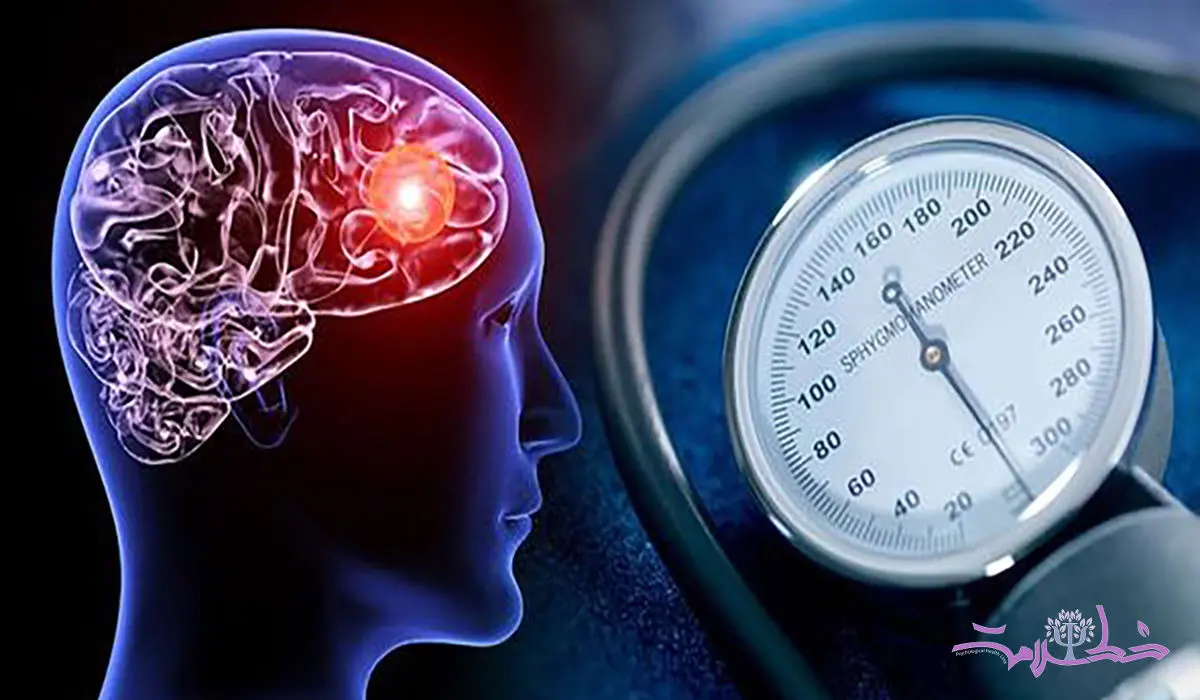 قبل از بالا رفتن فشار خون چه اتفاقی برای مغز می افتد؟ 