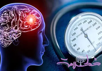 قبل از بالا رفتن فشار خون چه اتفاقی برای مغز می افتد؟ 