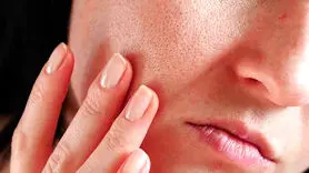 5 ترفند ساده و بدون هزینه برای جوان نگه داشتن پوست