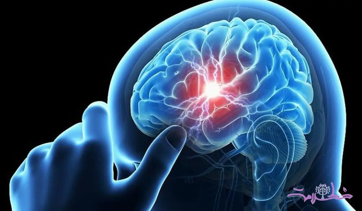  این علائم نشان می دهد یک قدمی سکته مغزی ایستاده اید