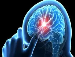  این علائم نشان می دهد یک قدمی سکته مغزی ایستاده اید