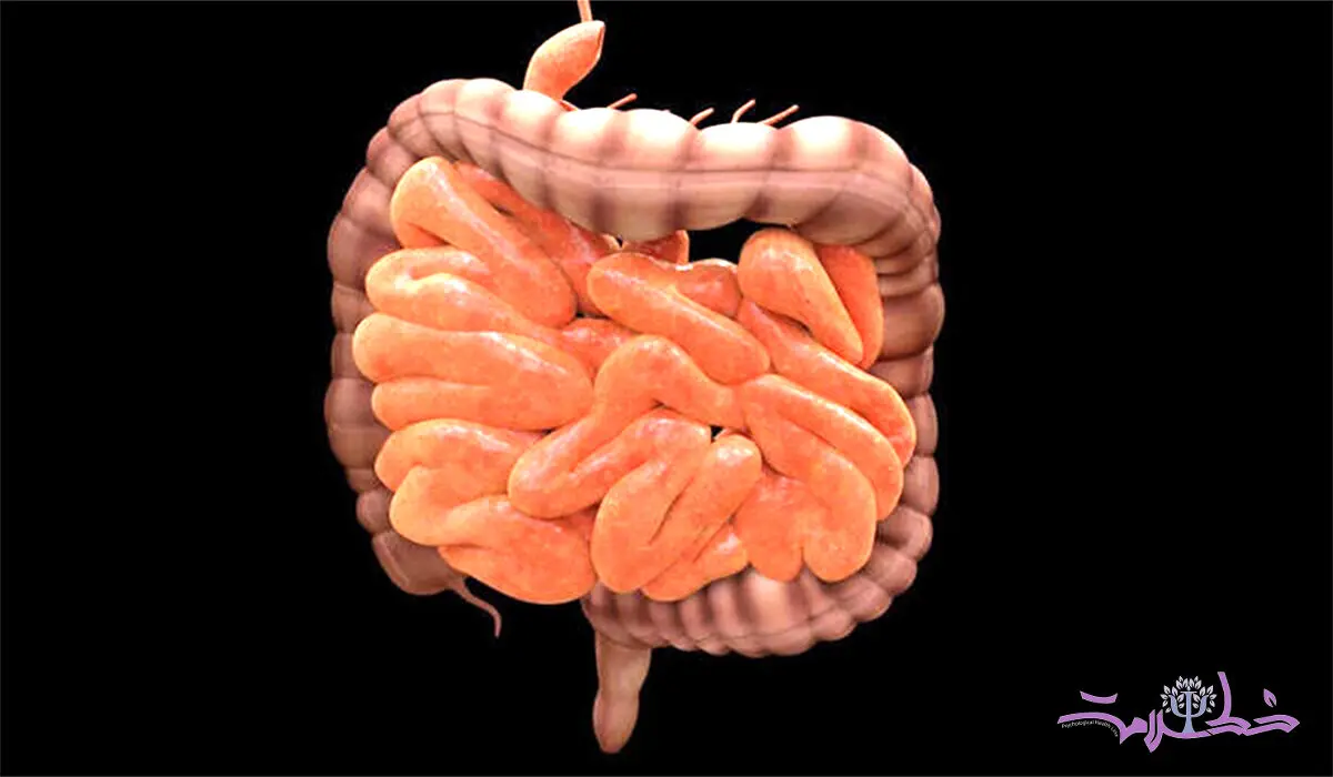 پژوهش جدید ارتباط قوی بین بیماری التهابی روده و مشکلات مفصلی را نشان می دهند