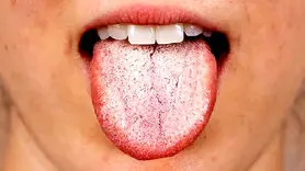 4 حالت زبان از توت فرنگی تا سفید و سیاه و جغرافیایی نشانگر چه وضعیتی از سلامتی است؟