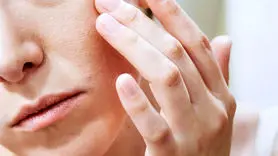 فیلم / 7 راه برای درمان شایع ترین بیماری پوستی 