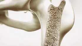 افراد دارای اندام باریک در معرض خطر پوکی استخوان هستند!