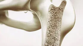 افراد دارای اندام باریک در معرض خطر پوکی استخوان هستند!