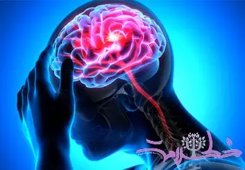 ۳ فاکتور مهم در بروز سکته مغزی!