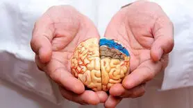 شیوه ای مدرن برای درمان آلزایمر