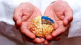 شیوه ای مدرن برای درمان آلزایمر