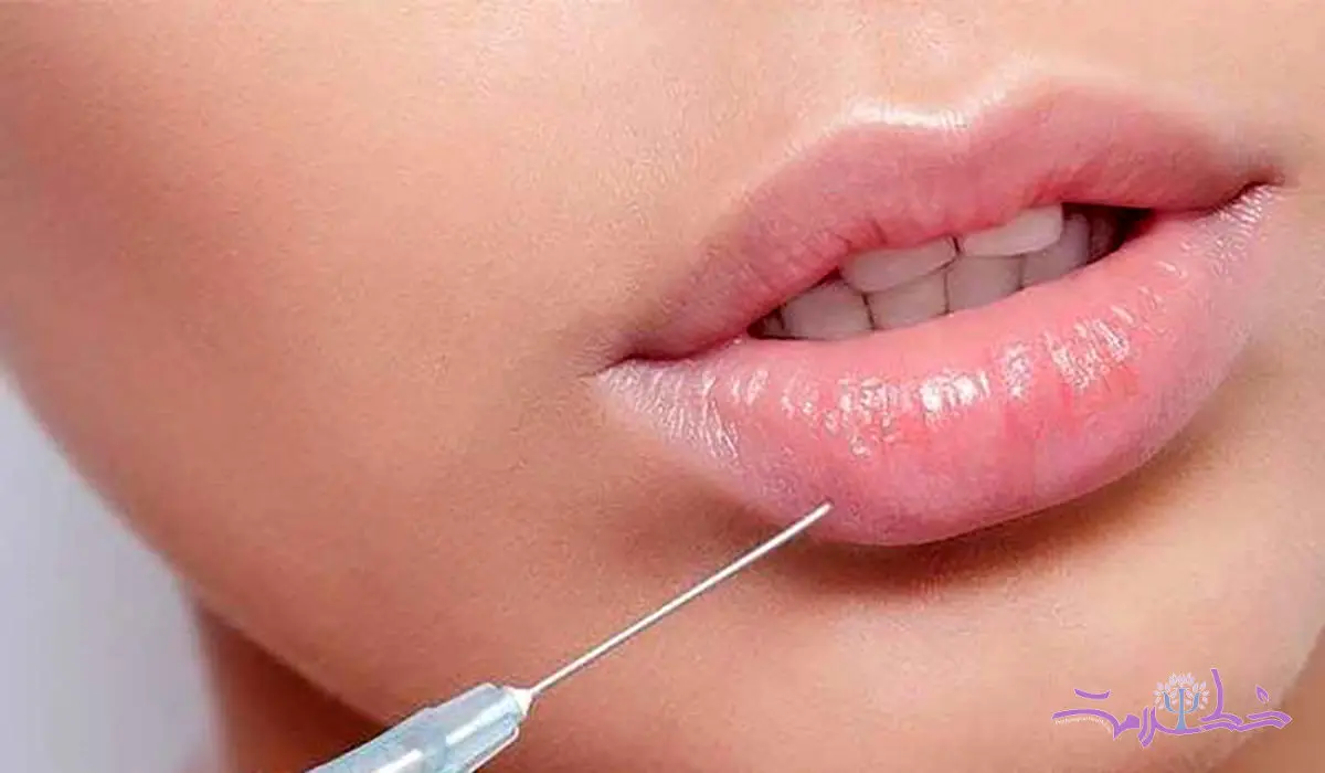ترند لبهای برجسته و زیبایی دیجیتال چگونه هویت را تغییر میدهد؟
