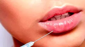 ترند لب‌های برجسته و زیبایی دیجیتال چگونه هویت را تغییر می‌دهد؟ 