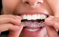 دندان‌ قروچه فقط یک عادت بد نیست!/ چرا بعضی افراد شب‌ها دندان‌هایشان را روی هم می‌سایند؟