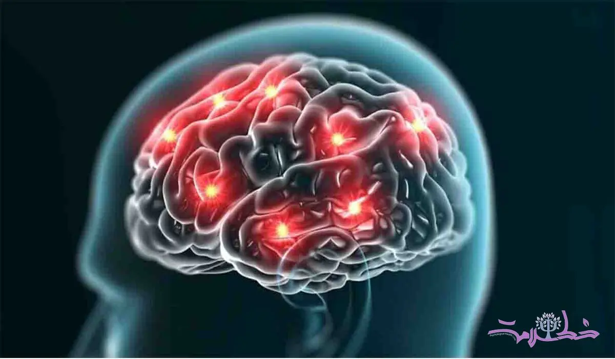 آیا در مغز سالم میکروب وجود دارد ؟