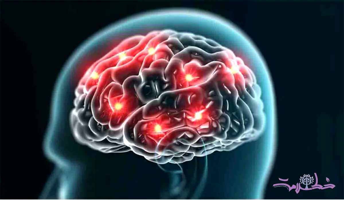 آیا در مغز سالم میکروب وجود دارد ؟