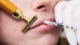 چرا سیاستمداران به عمل‌ های جراحی زیبایی علاقمند شده‌ اند؟ + پشت پرده چهره‌ های جوان قدرت