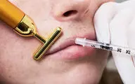 چرا سیاستمداران به عمل‌ های جراحی زیبایی علاقمند شده‌ اند؟ + پشت پرده چهره‌ های جوان قدرت