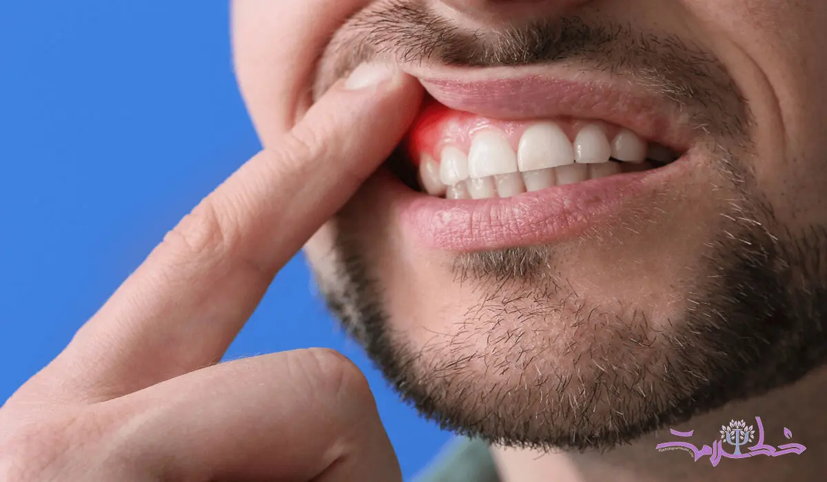 آیا خونریزی لثه هنگام مسواک زدن طبیعی است؟
