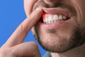 آیا خونریزی لثه هنگام مسواک زدن طبیعی است؟