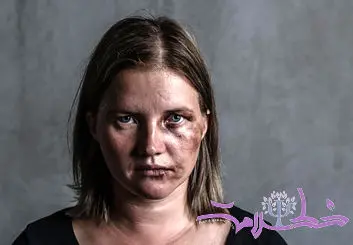 چرا قربانیان خشونت خانگی نمی توانند شریک شان را ترک کنند؟