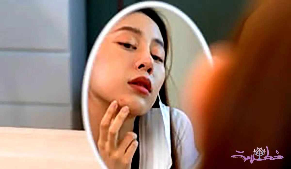 مشکلات کبدی روی صورت این علامت ها را می گذارد