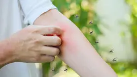 جدید ترین روش های رفع خارش جای نیش پشه