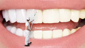 فیلم/5 شیوه برای سفید کردن دندان ها در خانه