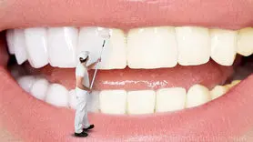 فیلم/5 شیوه برای سفید کردن دندان ها در خانه