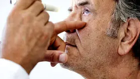 بیماری قلبی اول در چشم ها قابل تشخیص است! +  دو علامت مهم                                                                                             