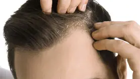 بخاطر فواید شگفت انگیز با موسیر آشتی کنید