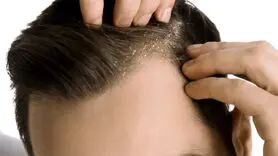 بخاطر فواید شگفت انگیز با موسیر آشتی کنید