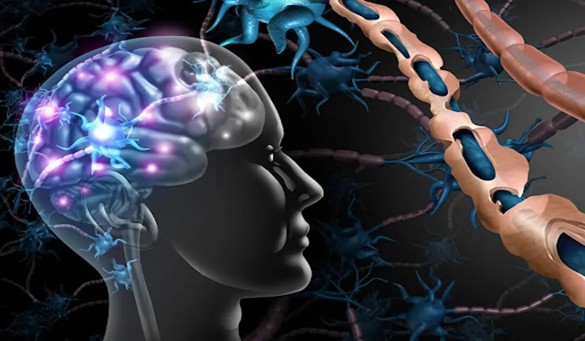 افسانه های رایج در مورد بیماری ام اس + در ام اس چه اتفاقی می افتد؟
