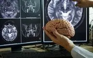 تحریک مغز در خانه درمان جدید افسردگی